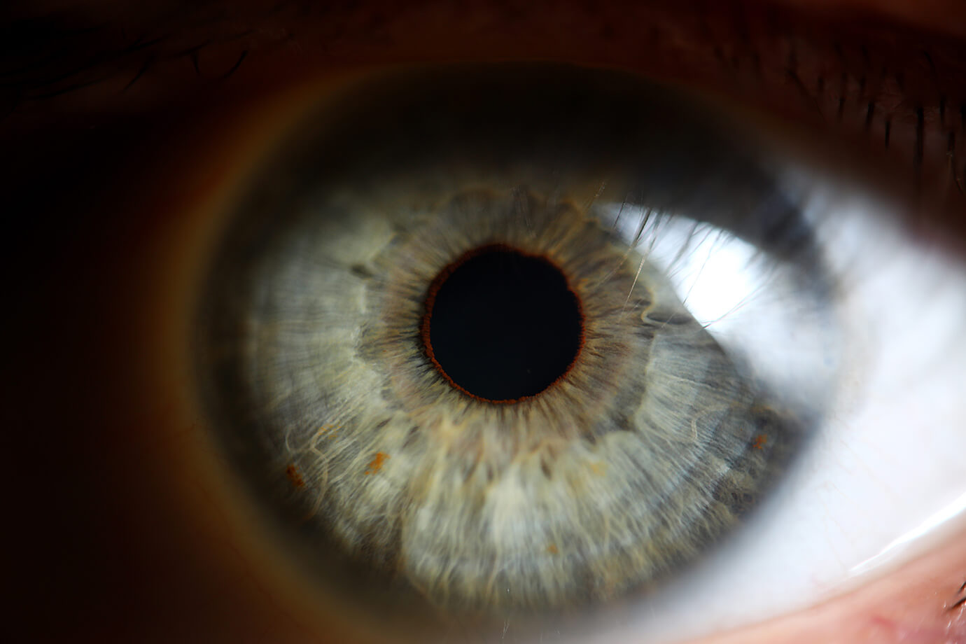 Irisdiagnostika - oči jako zdcadlo zdraví